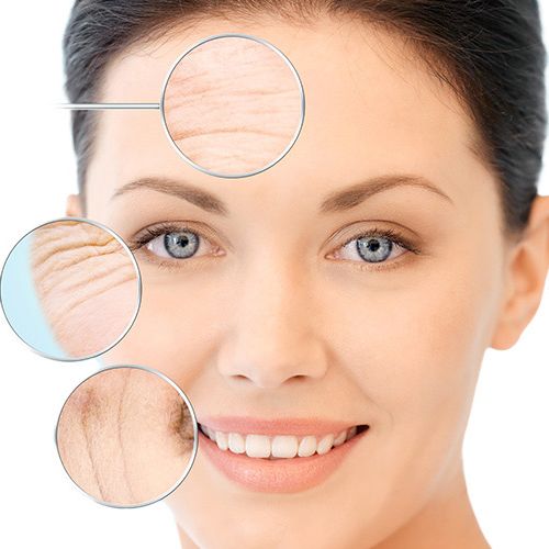 Anti-Aging-Behandlung - Botulinumtoxin - Medi-Kuss - Hamburg