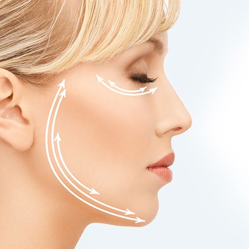Fadenlifting - Liquidlifting - Medi-Kuss - Hamburg
