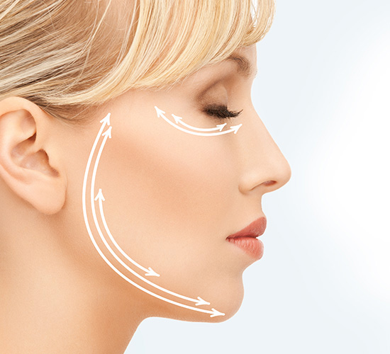 Fadenlifting - Liquidlifting - Medi-Kuss - Hamburg