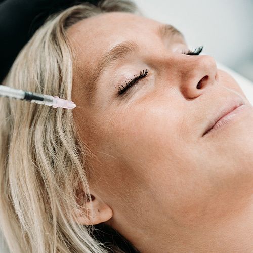 Faltenbehandlung mit Filler / Hyaluronsäure - Teoxane - Medi-Kuss - Hamburg Faltenbehandlung mit Filler / Hyaluronsäure - Teoxane - Medi-Kuss - Hamburg