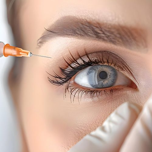 Mesotherapie - Falten - Praxis - Medi-Kuss - Hamburg