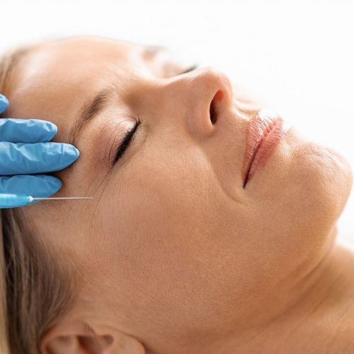 Vampir-Lifting - Gesicht - Aesthetik - Praxis - Medi-Kuss - Hamburg